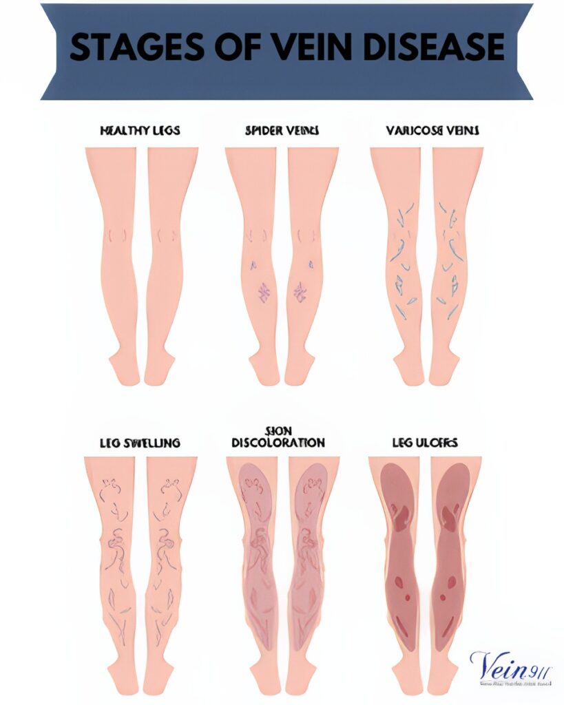 1748009049_Healthy-Leg-240x300-1-topaz-text-upscale-4x